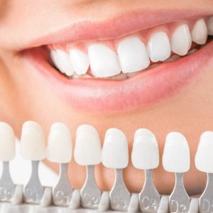 What is the Best Whitener for Your teeth? Portrait