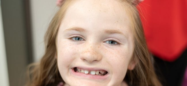 A Comprehensive Guide to Celebrating Tooth Fairy Day*