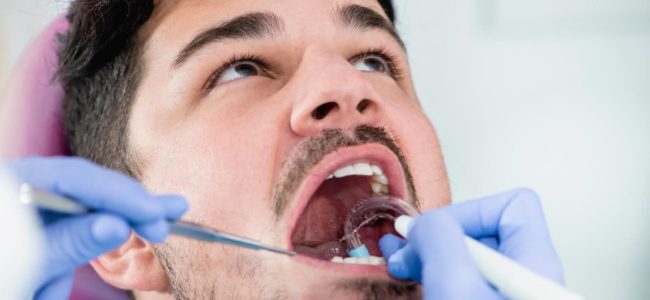 How Can I Remove Tartar From My Teeth?