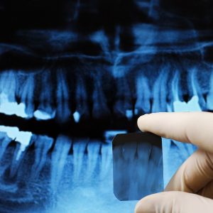 Why X-rays Are Important to Your Dental Health Portrait